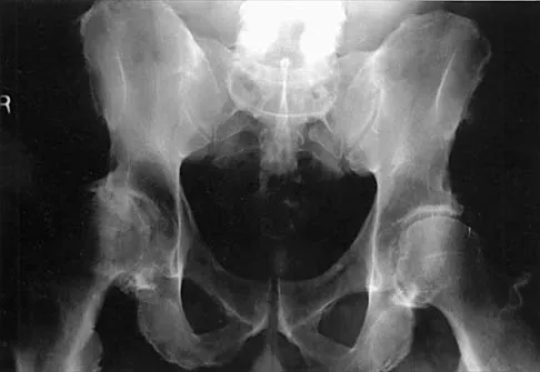 General Orthopedics 2026 Practice Questions: Set 11 (Solved) - Figure 39