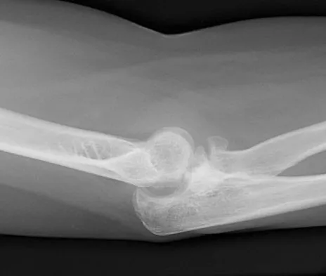 General Orthopedics 2026 Practice Questions: Set 11 (Solved) - Figure 41