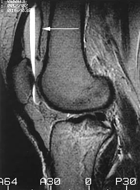 General Orthopedics 2026 Practice Questions: Set 11 (Solved) - Figure 45
