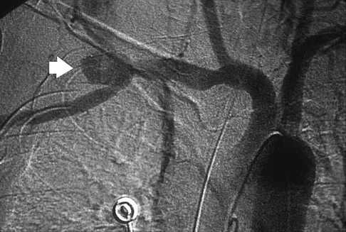 General Orthopedics 2026 Practice Questions: Set 11 (Solved) - Figure 46