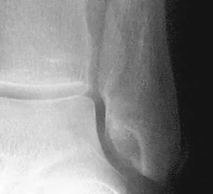 General Orthopedics 2026 Practice Questions: Set 11 (Solved) - Figure 5