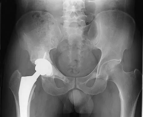 General Orthopedics 2026 Practice Questions: Set 11 (Solved) - Figure 53