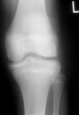 General Orthopedics 2026 Practice Questions: Set 11 (Solved) - Figure 56