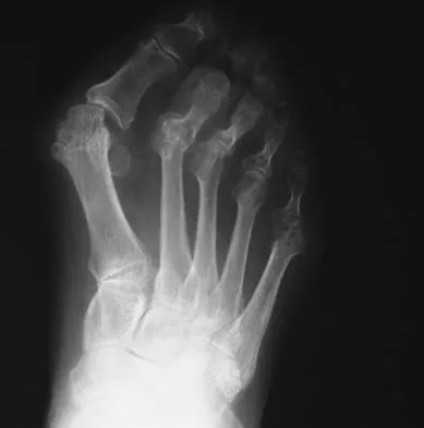 General Orthopedics 2026 Practice Questions: Set 11 (Solved) - Figure 58