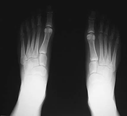 General Orthopedics 2026 Practice Questions: Set 11 (Solved) - Figure 6