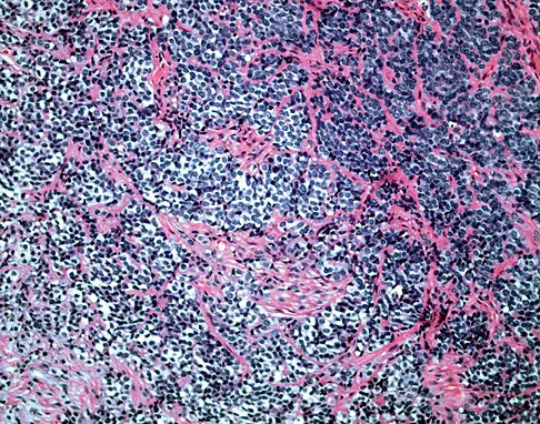 General Orthopedics 2026 Practice Questions: Set 11 (Solved) - Figure 63