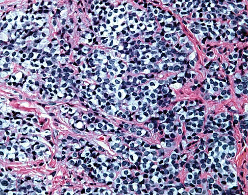 General Orthopedics 2026 Practice Questions: Set 11 (Solved) - Figure 64