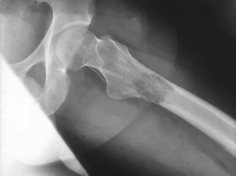 General Orthopedics 2026 Practice Questions: Set 11 (Solved) - Figure 68