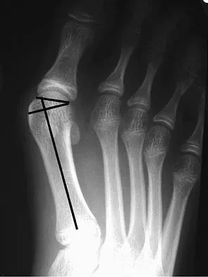 General Orthopedics 2026 Practice Questions: Set 11 (Solved) - Figure 70