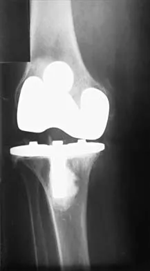 General Orthopedics 2026 Practice Questions: Set 11 (Solved) - Figure 72