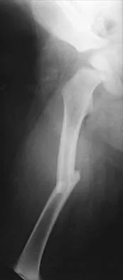 General Orthopedics 2026 Practice Questions: Set 11 (Solved) - Figure 75