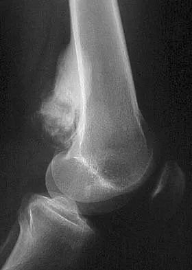 General Orthopedics 2026 Practice Questions: Set 11 (Solved) - Figure 77