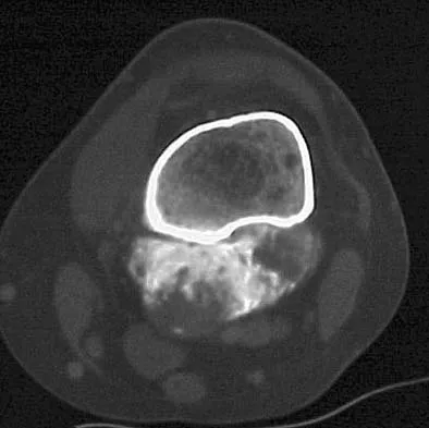 General Orthopedics 2026 Practice Questions: Set 11 (Solved) - Figure 78