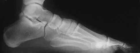 General Orthopedics 2026 Practice Questions: Set 11 (Solved) - Figure 8