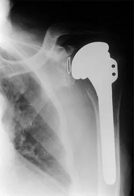 General Orthopedics 2026 Practice Questions: Set 11 (Solved) - Figure 83