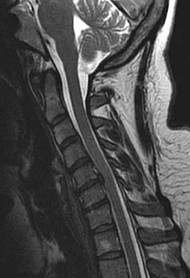 General Orthopedics Board Review 2026: High-Yield MCQs (Set 12) - Figure 101