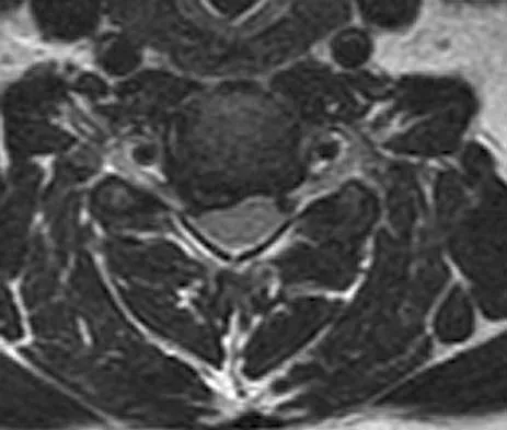 General Orthopedics Board Review 2026: High-Yield MCQs (Set 12) - Figure 102