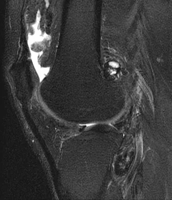 General Orthopedics Board Review 2026: High-Yield MCQs (Set 12) - Figure 12