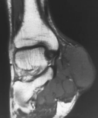 General Orthopedics Board Review 2026: High-Yield MCQs (Set 12) - Figure 15