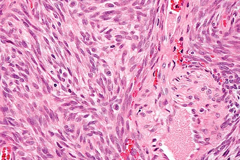 General Orthopedics Board Review 2026: High-Yield MCQs (Set 12) - Figure 17