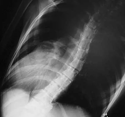 General Orthopedics Board Review 2026: High-Yield MCQs (Set 12) - Figure 22