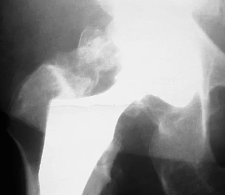 General Orthopedics Board Review 2026: High-Yield MCQs (Set 12) - Figure 29