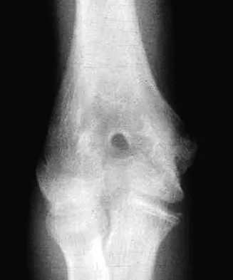General Orthopedics Board Review 2026: High-Yield MCQs (Set 12) - Figure 32