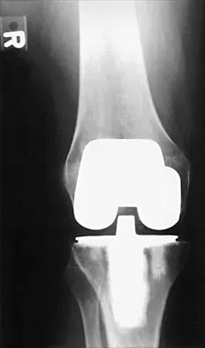 General Orthopedics Board Review 2026: High-Yield MCQs (Set 12) - Figure 37