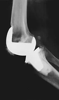 General Orthopedics Board Review 2026: High-Yield MCQs (Set 12) - Figure 38