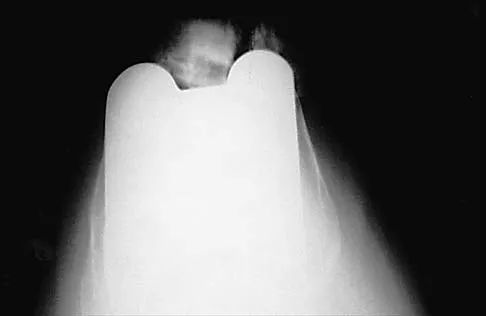 General Orthopedics Board Review 2026: High-Yield MCQs (Set 12) - Figure 39