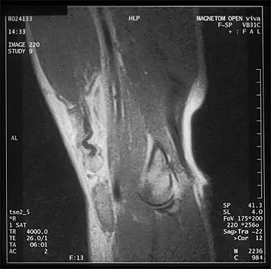 General Orthopedics Board Review 2026: High-Yield MCQs (Set 12) - Figure 4