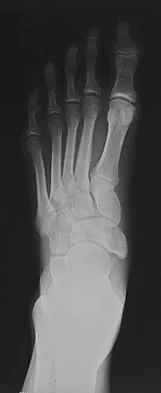 General Orthopedics Board Review 2026: High-Yield MCQs (Set 12) - Figure 40