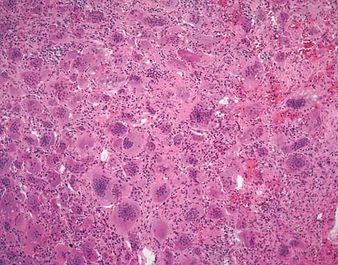 General Orthopedics Board Review 2026: High-Yield MCQs (Set 12) - Figure 49