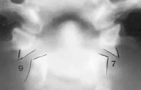 General Orthopedics Board Review 2026: High-Yield MCQs (Set 12) - Figure 5