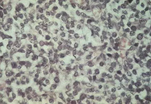 General Orthopedics Board Review 2026: High-Yield MCQs (Set 12) - Figure 56