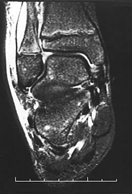 General Orthopedics Board Review 2026: High-Yield MCQs (Set 12) - Figure 63