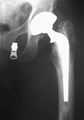 General Orthopedics Board Review 2026: High-Yield MCQs (Set 12) - Figure 69