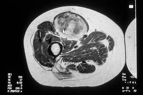 General Orthopedics Board Review 2026: High-Yield MCQs (Set 12) - Figure 83