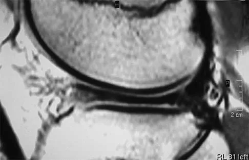 General Orthopedics Board Review 2026: High-Yield MCQs (Set 12) - Figure 89