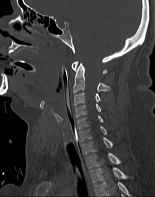 General Orthopedics 2026 Practice Questions: Set 13 (Solved) - Figure 11