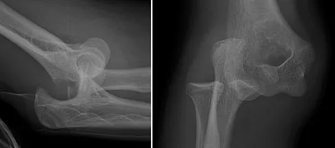 General Orthopedics 2026 Practice Questions: Set 13 (Solved) - Figure 12