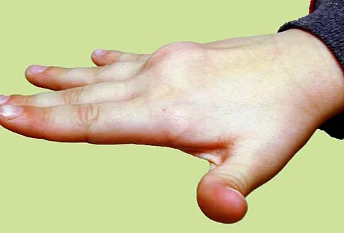 General Orthopedics 2026 Practice Questions: Set 13 (Solved) - Figure 2