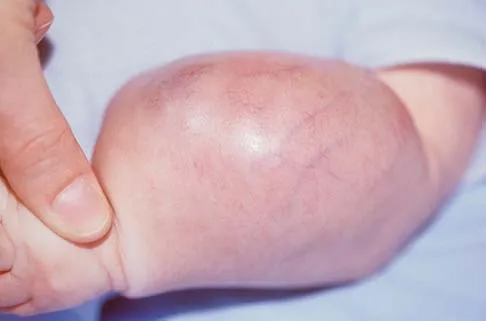 General Orthopedics 2026 Practice Questions: Set 13 (Solved) - Figure 20