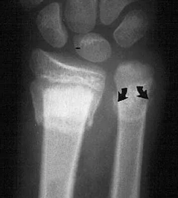 General Orthopedics 2026 Practice Questions: Set 13 (Solved) - Figure 23