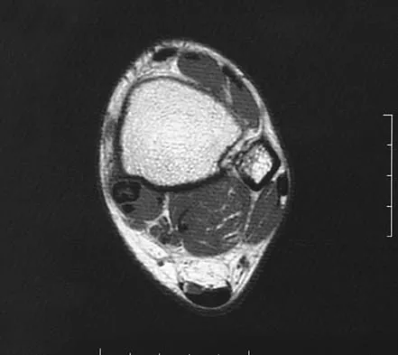 General Orthopedics 2026 Practice Questions: Set 13 (Solved) - Figure 26