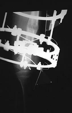 General Orthopedics 2026 Practice Questions: Set 13 (Solved) - Figure 28