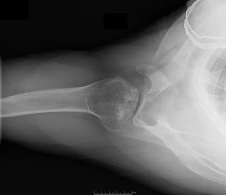 General Orthopedics 2026 Practice Questions: Set 13 (Solved) - Figure 29