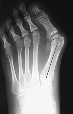 General Orthopedics 2026 Practice Questions: Set 13 (Solved) - Figure 31