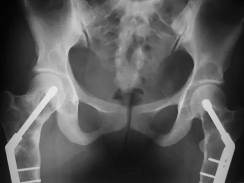 General Orthopedics 2026 Practice Questions: Set 13 (Solved) - Figure 34