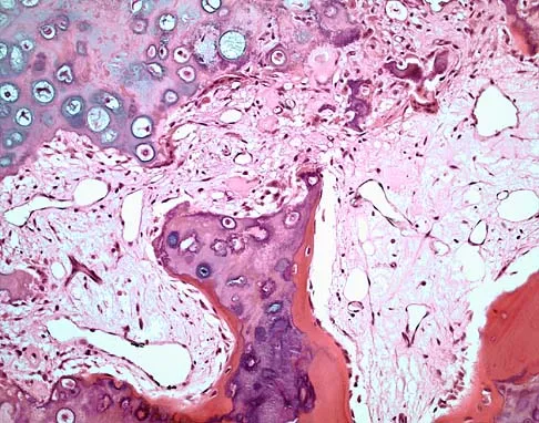 General Orthopedics 2026 Practice Questions: Set 13 (Solved) - Figure 38